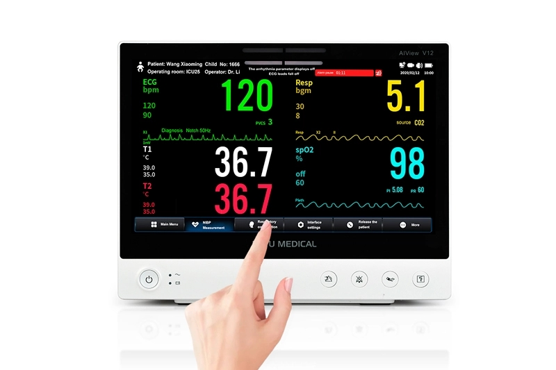 I monitor del paziente possono essere integrati con la telemedicina per fornire monitoraggio e diagnosi remoti?
